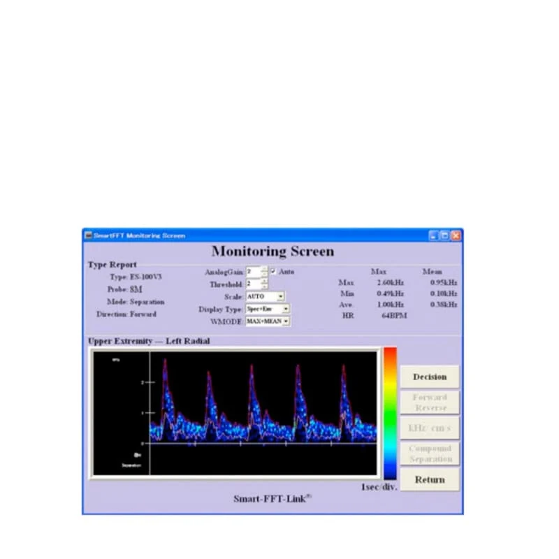 Smart-V-Link Software