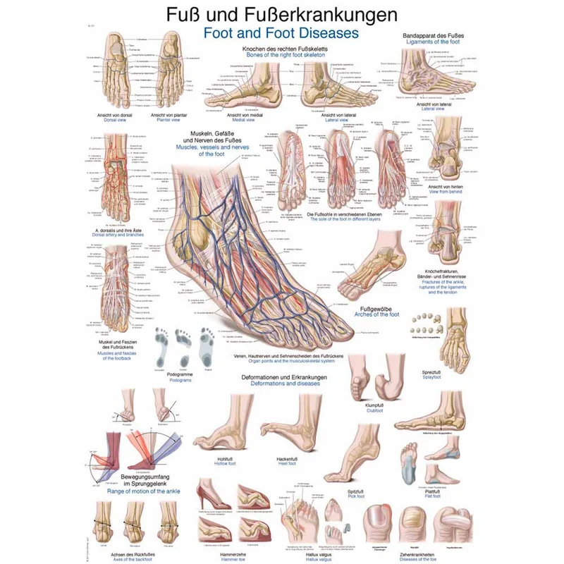 Erler Zimmer anat. Lehrtafel - Fuß und Fußerkrankungen, 2 Gr.