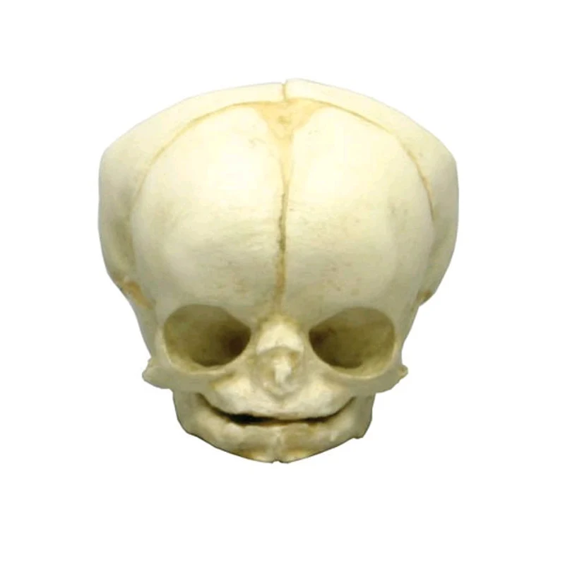 Erler Zimmer Fetusschädel Anatomie Modell, versch. Entwicklungs-Wochen