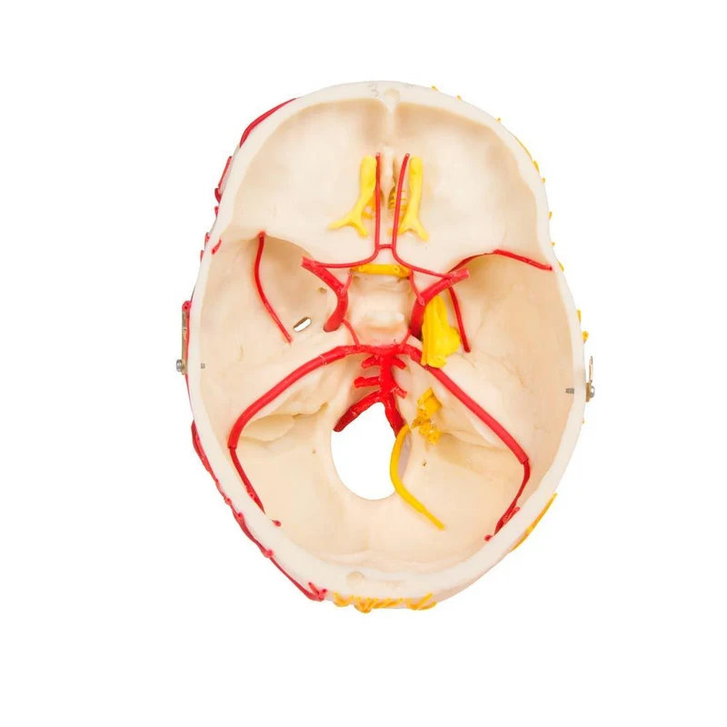 Erler Zimmer Modell, neurovaskulärer Schädel mit Gehirn